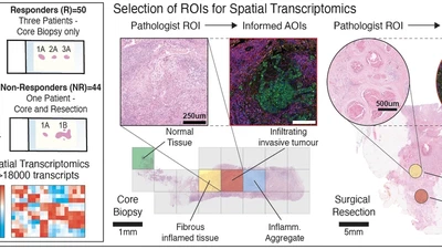 SMART: A Spatio-Molecular Atlas of Response Trajectories in Triple-Negative Breast Cancer featured image